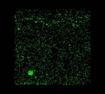 Sección D – Acumulación de partículas silíceas